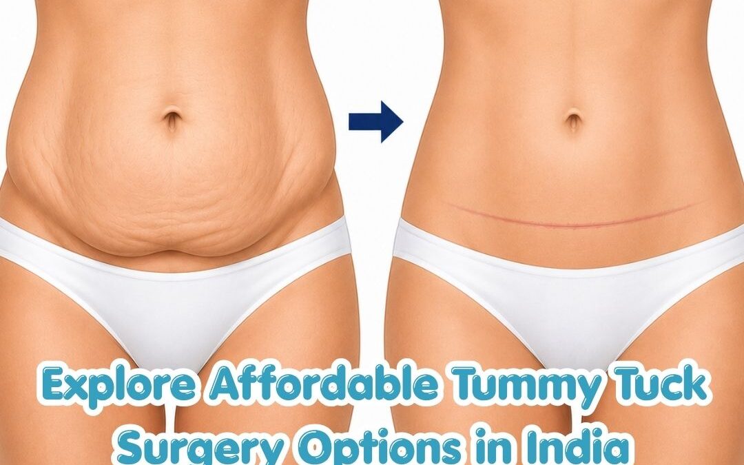 Explore Affordable Tummy Tuck Surgery Options in India