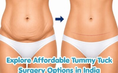Explore Affordable Tummy Tuck Surgery Options in India